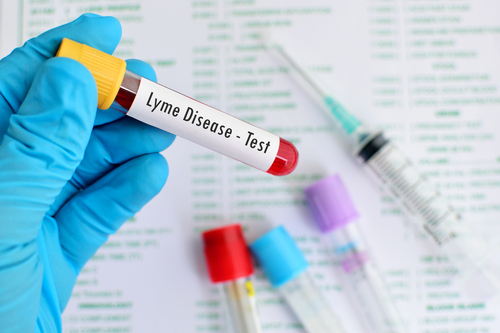 Why Most Lyme Disease Tests Fail Patients (and what to do instead)